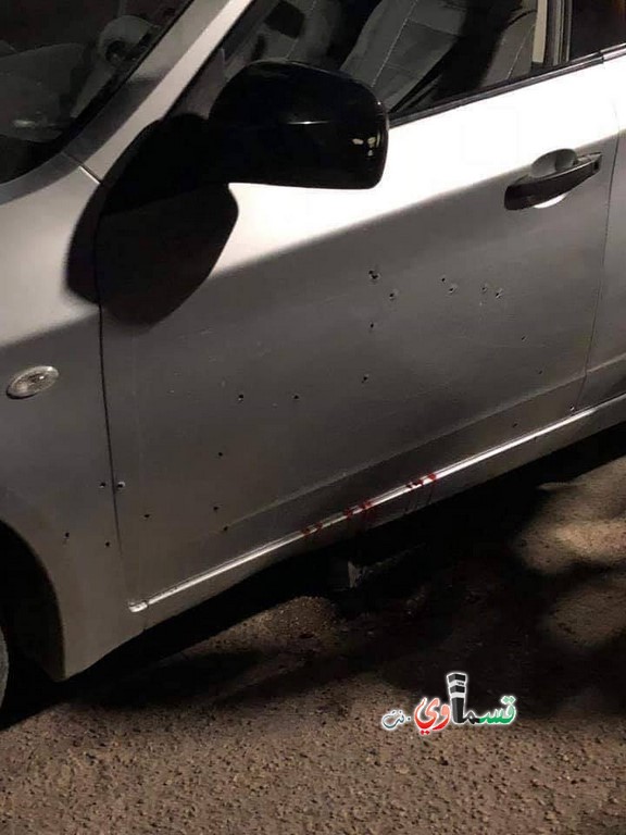 اصابة رجل بجراح خطيرة جراء تعرضه لإطلاق نار في مدينة قلنسوة